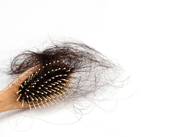Hair loss diagnosis at Sumanova Hair Clinic